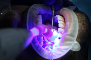 dentist, oral health, dental health